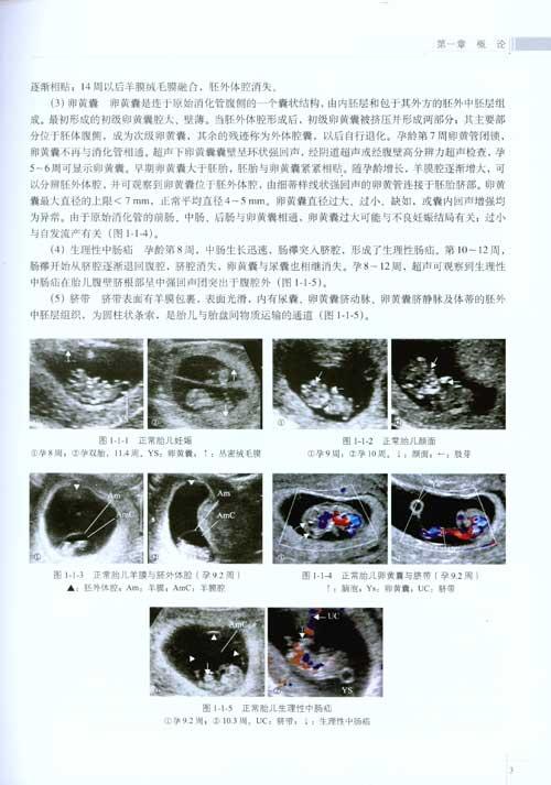 胎儿畸形产前超声筛查病例解读-范斯萍