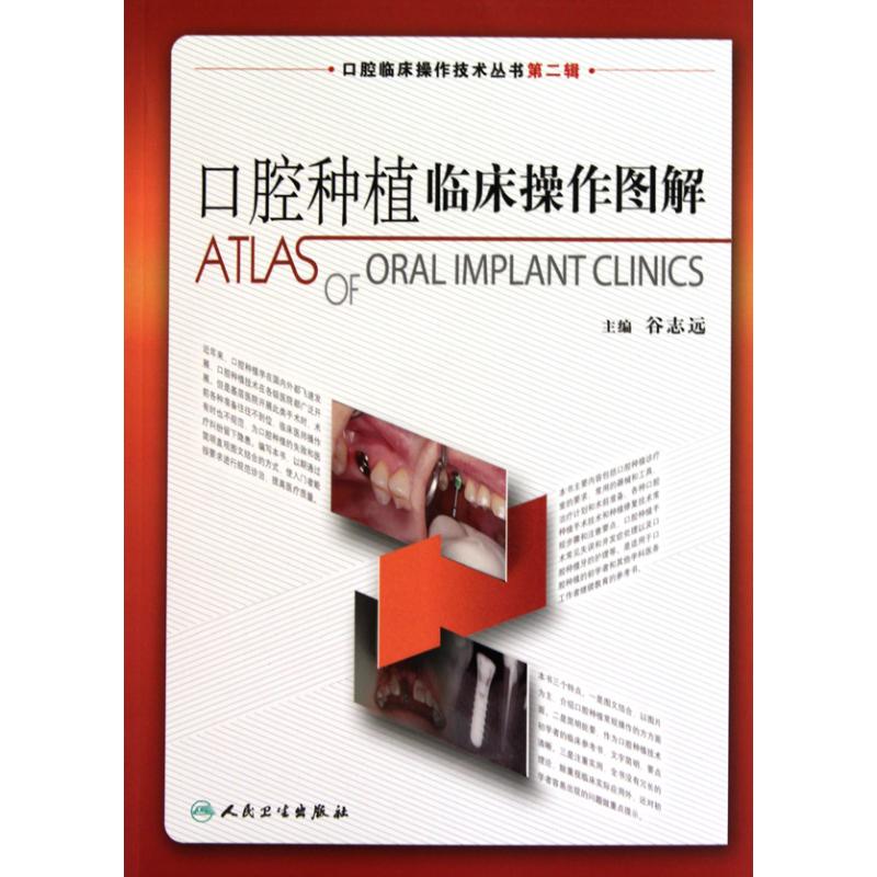  口腔种植临床操作图解(口腔临床操作技术丛书) 