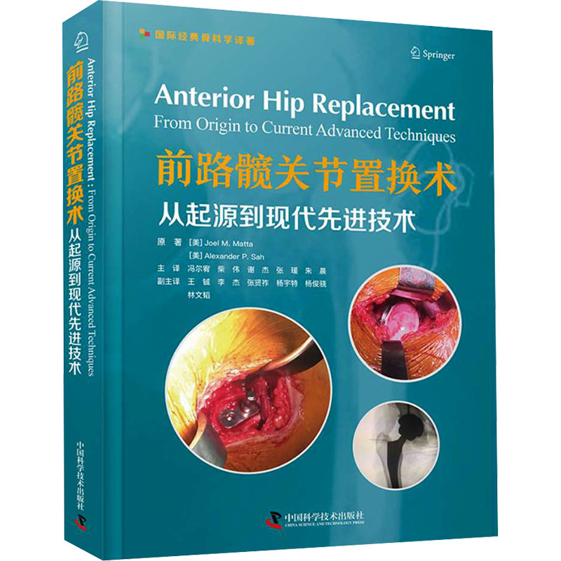  前路髋关节置换术 从起源到现代先进技术 